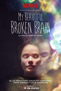 Cartel de My Beautiful Broken Brain